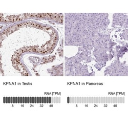 Importin alpha 5/KPNA1/SRP1 Antibody, Novus Biologicals 25 &mu;L; Unlabeled:Antibodies,